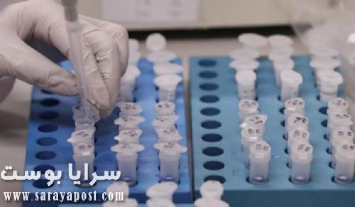 جامعة سعودية: نتائج بحثية مشجعة للقضاء على كورونا