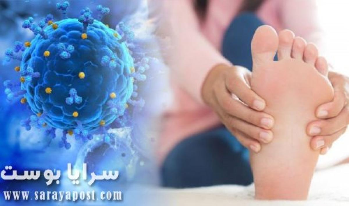 علامة جديدة تؤكد الإصابة بـ فيروس كورونا تظهر فى القدم .. هل لاحظتها ؟!