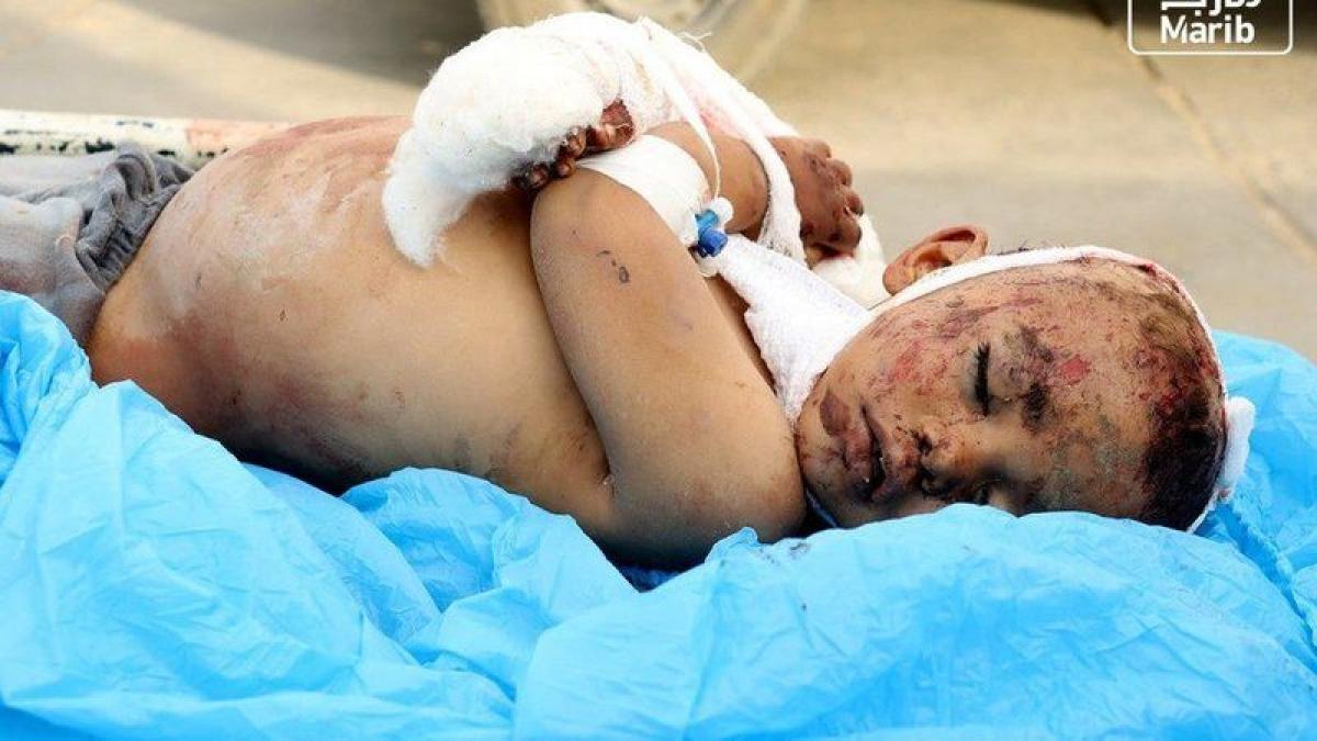 صور مؤلمة لمجزرة الحوثي بمأرب.. مقتل طفلين وإصابة 27 مدنياً حصيلة
