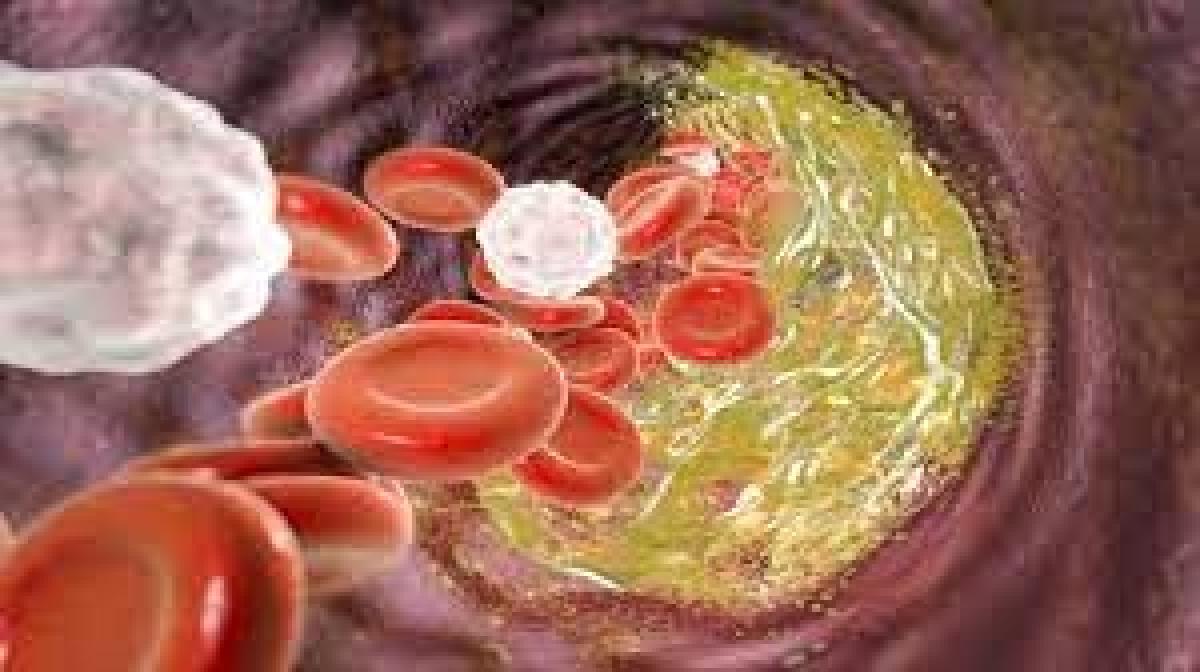 استشاري يكشف أفضل الطرق للتحكم بنسبة «الكوليسترول» بالدم
أهم الاخبار