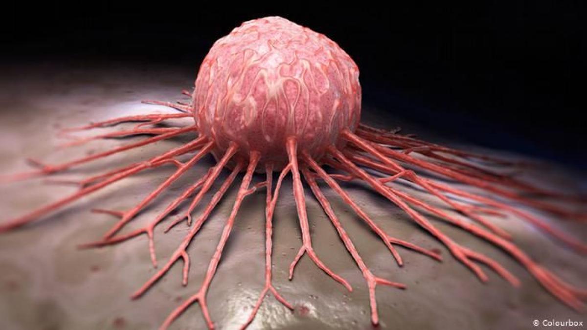 اكتشاف علاج جديد للسرطان.. يُقلص الأورام ويمنح أملاً للمرضى الميؤوس من شفائهم
أبرز المواد